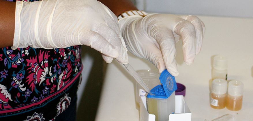 Point-of-care TB diagnosis may lead to faster treatment